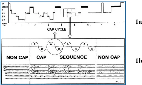 Figure 1.2 Schematic representation of cyclic alternating pattern (CAP).  