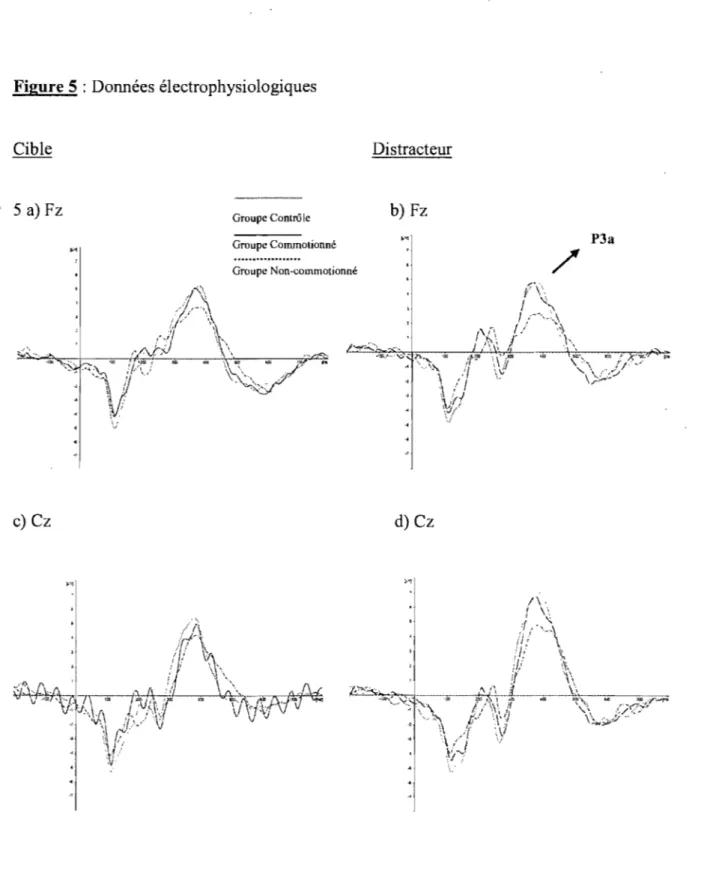 Figure 5 :  Données électrophysiologiques  Cible  Distracteur  ,  5 a) Fz  Groupe Controle  b) Fz  Groupe Commotionné  Groupe Non-commotionné  P3a  /'  .