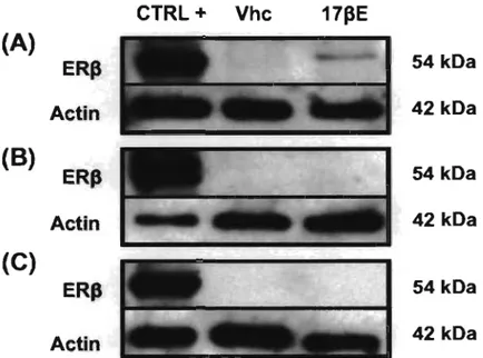 Figure 5  CTRL+  Vhc  17pE  (A)  ERp  54 kDa  Actin  42 kDa  (B)  ERp  54 kDa  Actin  42 kDa  (C)  ERp  54kDa  Actin  42 kDa 