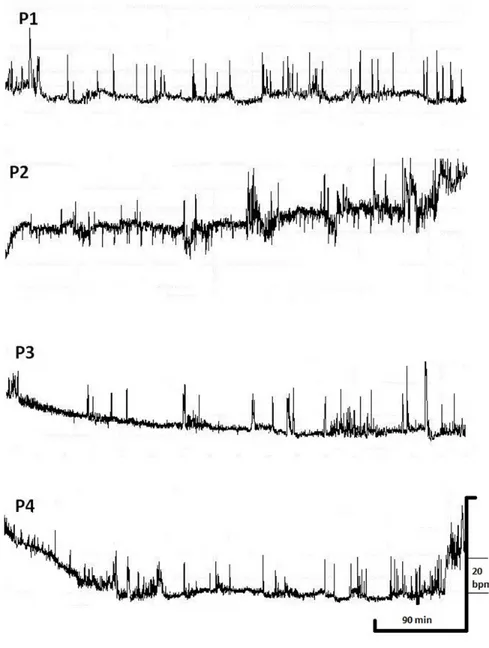 Figure 1. Nocturnal Heart Rate pattern; P1 : despite the fact that heart rate 