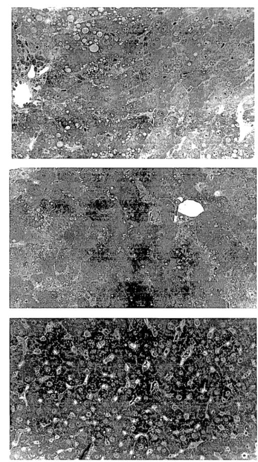 Figure 2.  Light microscopy ofliver sections in rats fed control diet (top),  choline-enriched diet (middle), and lecithin-enriched diet (bottom)