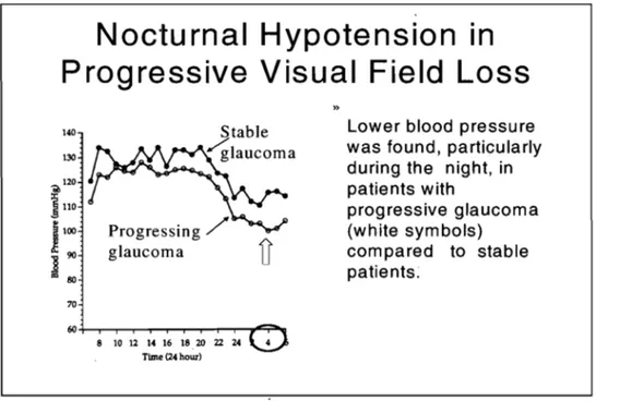 Figure  1.6:  Nocturnal  hypotension  in  progressive  visual  field  loss.  Lower  levels  of  blood  pressure  were  found,  particularly  during  the  night,  in  patients  with  progressive  glaucoma (arrow) compared to  stable glaucoma patients