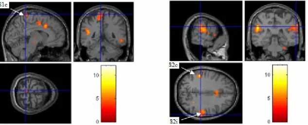 Figure 5-3. Group t map of GLM results for Level-1 stimulation (Threshold of 0.05 FDR  corrected)