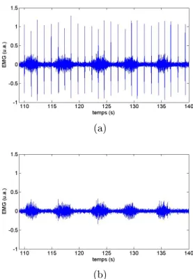 Fig. 2.8  Filtrage de l'artefact ECG sur l'EMG DI . (a) EMG DI avec l'artefact ECG.