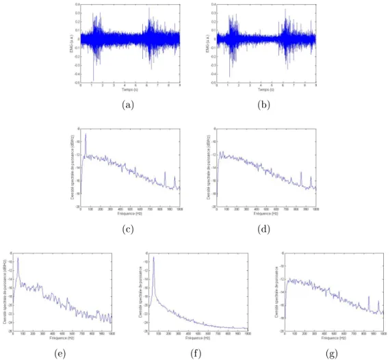 Fig. 2.10  Exemple de ltrage du 50 Hz sur un EMG AN . (a) Signal à ltrer. (b)