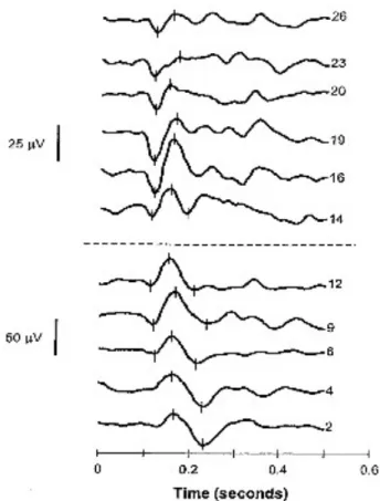 Figure 2 : Courbes moyennes de réponses aux PEVs en couleur en fonction de l’âge (n  = 38) (Madrid &amp; Crognale, 2000)