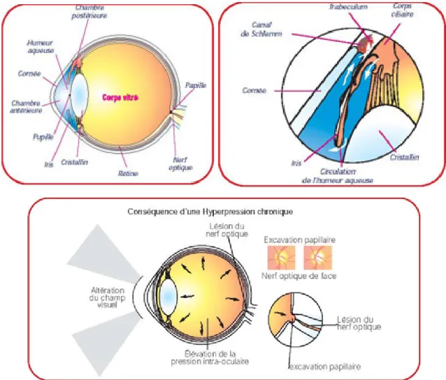 Figure 1.1 :  L’anatomie de l’œil et la physiopathologie du glaucome (D’après  26 ). 
