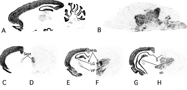Figure 6 : Photos comparatives de la distribution des ARNm VGLUT1 (A, C, E, G) et 