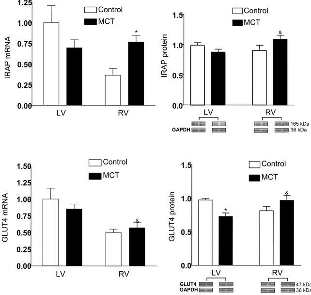 Figure 7. Effect of MCT on IRAP and GLUT4 gene and protein expressions in  the right and the left ventricle