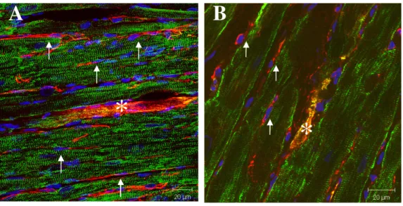 Fig.  2  -  The  presence  of  structurally  and  morphologically  immature  nestin (+) cardiac myocyte-like cells in 3-week post-MI adult rats