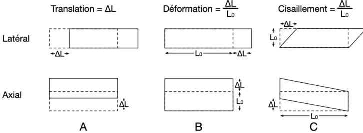 Figure 6. –  Schéma illustrant les 3 composantes du mouvement d’un tissu. Les composantes de  translation (A), de déformation (B) et de cisaillement (C) sont calculées par l’analyse  par élastographie d’une région d’intérêt