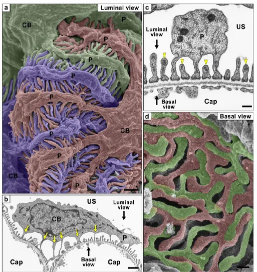 Figure 10. Podocyte subcellular compartments showed by conventional SEM and TEM.  (a) Conventional SEM image