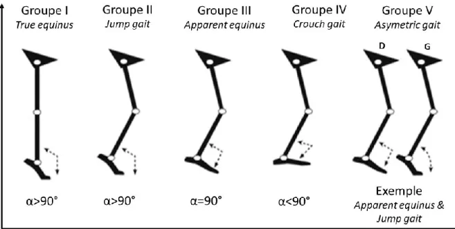 Figure 2 : Représentation schématique des différents patrons de marche observés chez les 