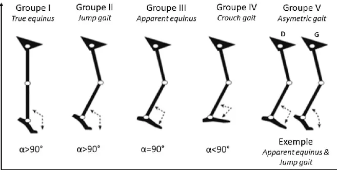 Figure 2 : Représentation schématique des différents patrons de marche observés chez les 