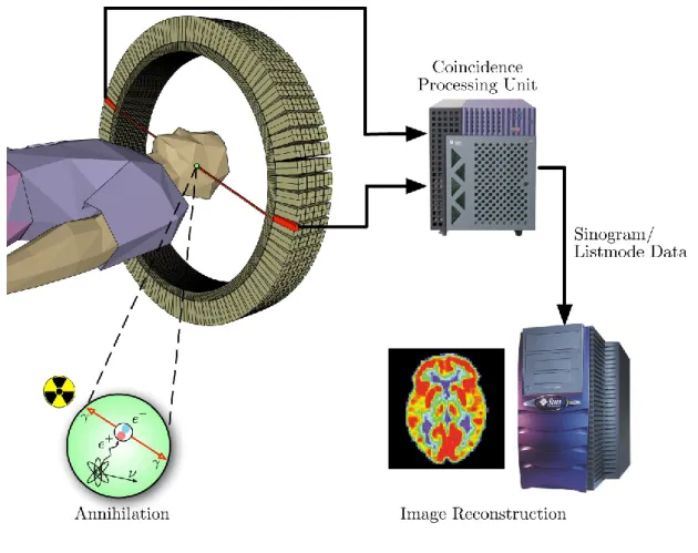 Figure 6. PET acquisition process 