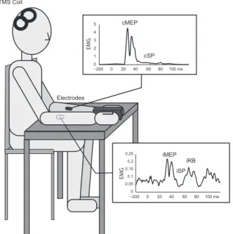 Figure 4. –   EMG Response to TMS Over the Right M1 in Wrist Muscles. 