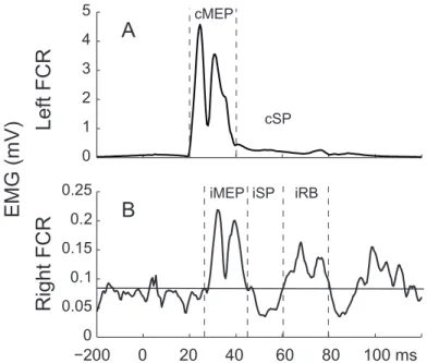 Figure 6. –   Example of TMS Responses in Left and Right FCR.  