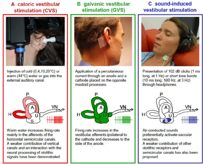 Figure 2.7. Différentes techniques de stimulation vestibulaires utilisées en laboratoire