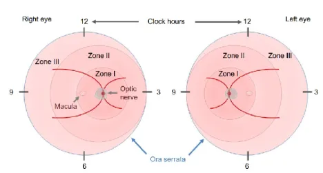 Figure 13. The Classification of ROP 