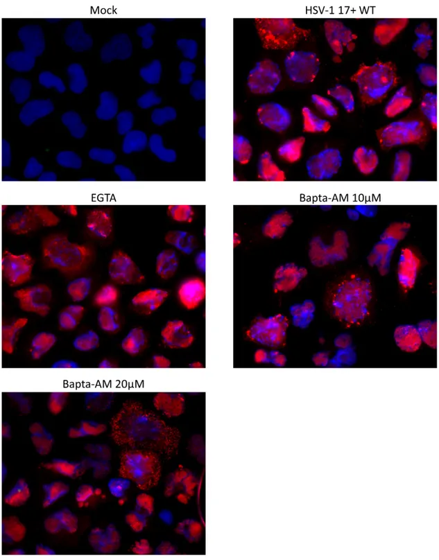 Fig 6.  Viral localization inside the cell is not affected by post entry calcium  level changes 