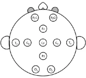 Figure 2. –   Placement standard pour les électrodes à l’EEG, selon le système 10-20 modifié pour les 