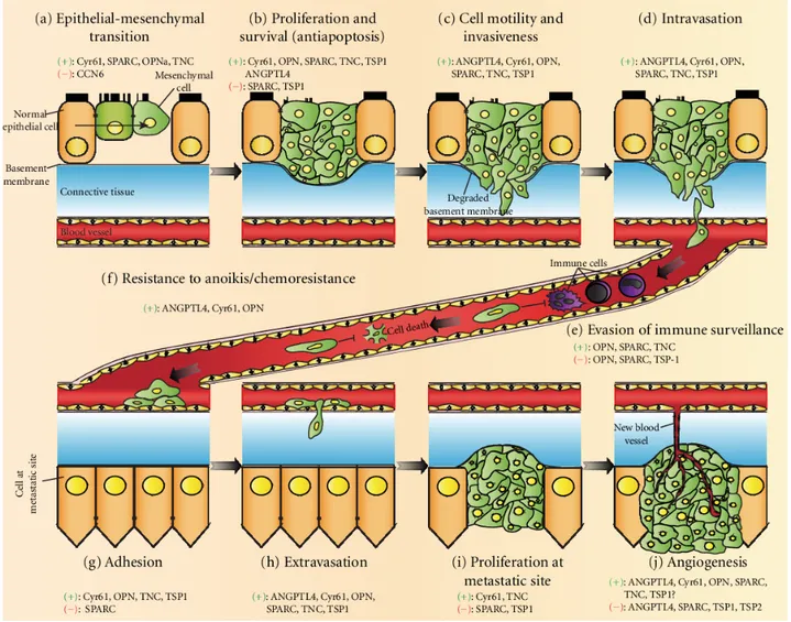 Figure 3: MPs in metastatic cancer development. Different MPs are implicated at each stage  of cancer development