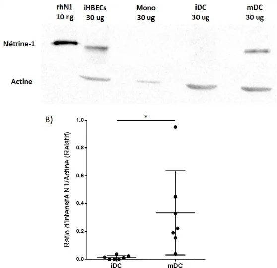 Figure  5.  Les  cellules  dendritiques  augmentent  de  façon  significative  leur  expression de la protéine Nétrine-1 lors de leur maturation