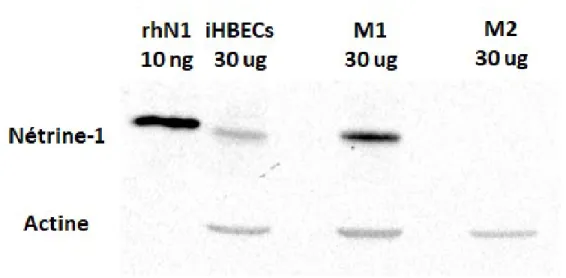Figure  9.  Les  macrophages  M1  expriment  la  protéine  Nétrine-1,  mais  pas  les  macrophages M2
