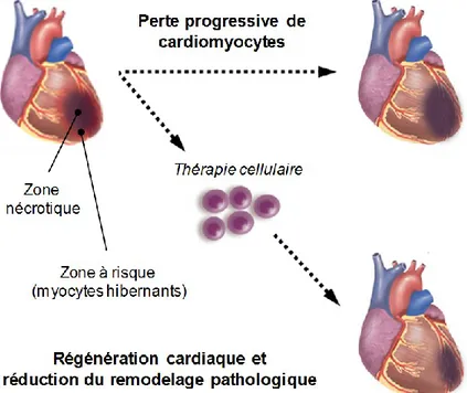 Figure 2.  Conceptualisation de la thé rapie cellulaire cardiaque. 