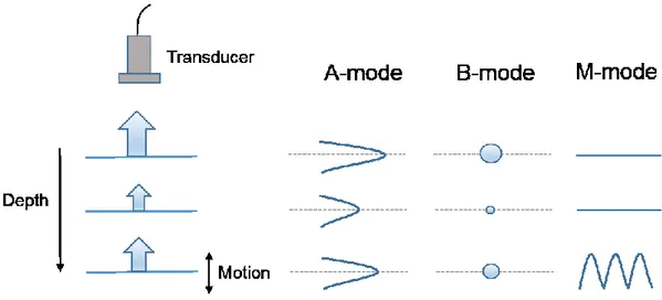 Figure  3.1  Gray-scale  imaging  modes.  Display  examples  of  A-mode,  B-mode  and  M- M-mode with respect to static and moving objects
