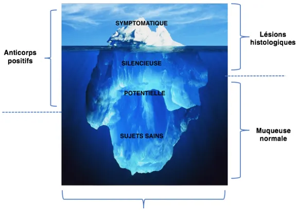Figure  7:  modèle  de  l’iceberg  cœliaque.  Ce  modèle  visuel  permet  de  représenter  le 
