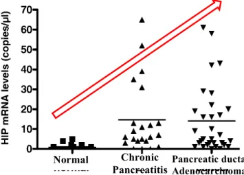 Figure  13:  Real-time  quantitative  RT-PCR:  mRNA  was  extracted  from  pancreatic  tissues  as  described  in  the  Methods  section