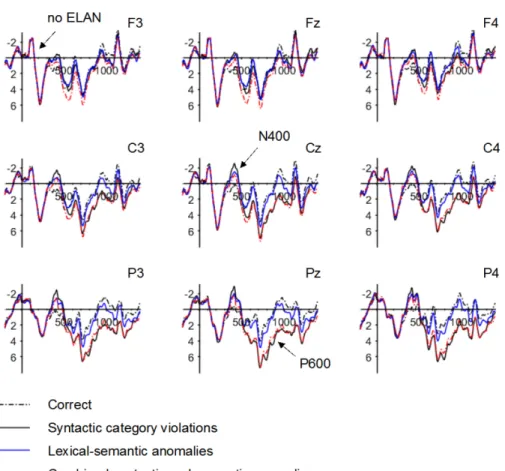 Figure 3.  Grand average waveforms for the four experimental conditions.  