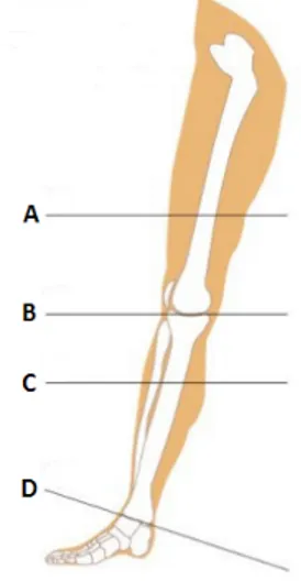 Figure 4. Niveaux d’amputation du membre inférieur (avec permission de Bakker et al., 2016)