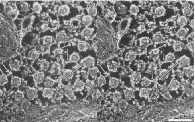 Figure 1.4. Ultrastructure du cytosquelette d’actine présynaptique d’un MN. 