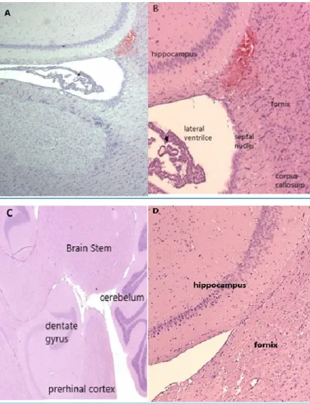 Figure 3 Blood in SAH sections. 