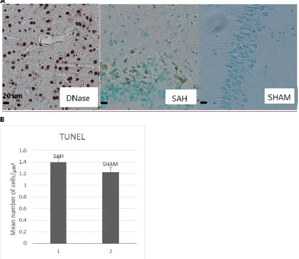 Figure 5 SAH induces a little more apoptosis. 