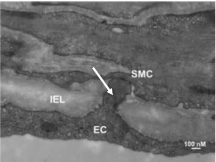 Figure 2.  La projection  myoendothéliale en microscopie 