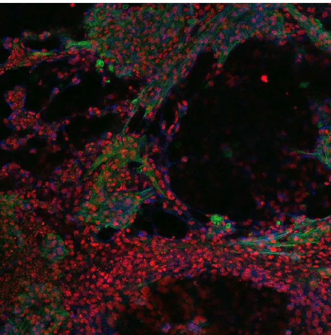 Figure 1: Immunomarquage d'un tissu dérivé de cellules souches de souris par le protocole  proposé, où un phénotype de cardiomyocyte est démontré par la présence de Cn43 (rouge)  et par la cTnT (vert)