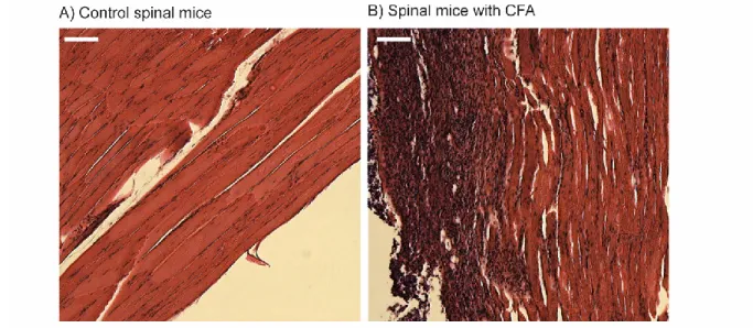 Figure 2.1. CFA-induced chronic inflammatory changes in lumbar muscles. 