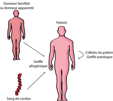 Figure 8: Types de greffes de cellules souches hématopoïétiques. 