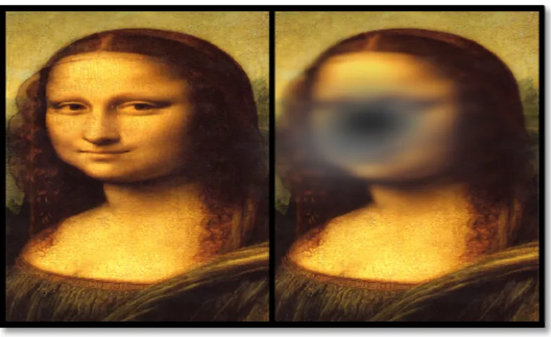 Figure 7: AMD interrupts detail visual recognition and central vision 