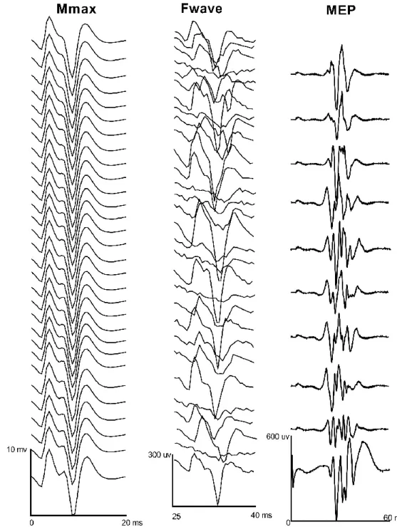 Figure 4.4: Representational traces of Mmax, Fwave and motor evoked potentials in one participant in the abductor pollicis  brevis 
