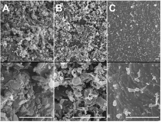 Figure 3 : Scanning electron microscope images of colonized microparticles 