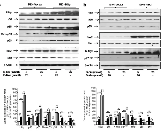 Figure  2-7  Effect  of  high  glucose  on  different  genes  of  MK4  transfected  cells  analyzed  by  western blot