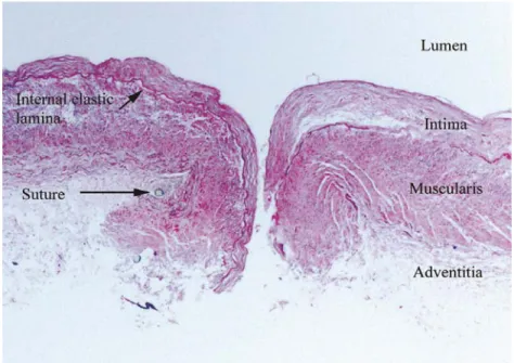 Figure  9.  Histologic  appearance  of  Thiel  embalmed  vessel.  Histologic  slide  showing  the 