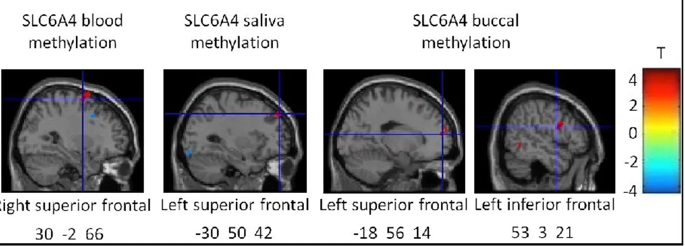 Figure 1. T-statistics maps of the positive association between regional prefrontal gray matter 