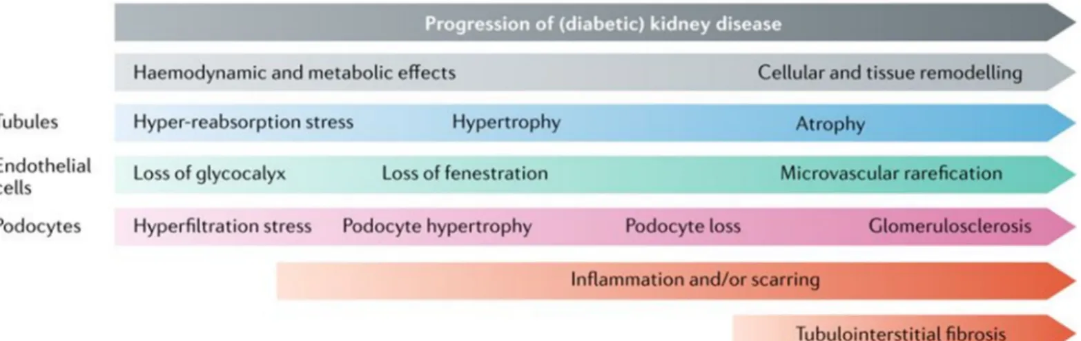 Figure 1-11: Pathophysiology and progression of DN (62). 