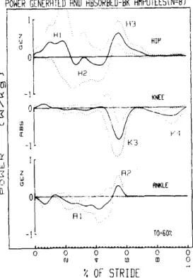 Figure 7- Average sagittal plane ankle, knee and hip power profiles in 8 below- below-knee amputees (top to bottom, respectively)