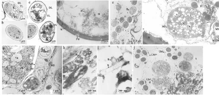 Figure 4    Electron micrographs shows similarities between the isolated fungi and fungal structures inside the Scutellospora 